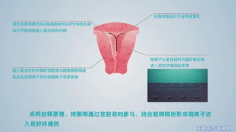 湖北大禹醫(yī)療器械有限責(zé)任公司招商信息與公司簡介